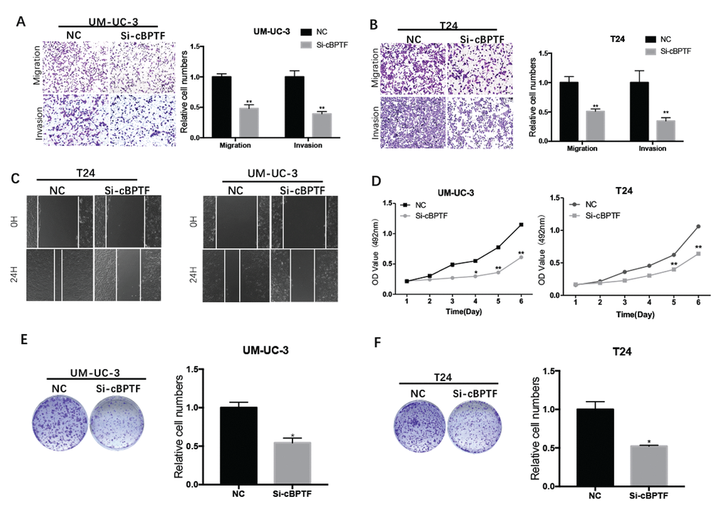 Circ-BPTF promotes progression of BCa cells in vitro. (A, B and C) Effects of circ-BPTF on cell migratory and invasive capabilities were assessed by transwell migration, Matrigel invasion and wound-healing assays. (D-F) MTS and clone-formation assays showed that the proliferative ability was decreased in T24 and UM-UC-3 cells transfected with si-circ-BPTF. Data indicate the means ± SEM. *P
