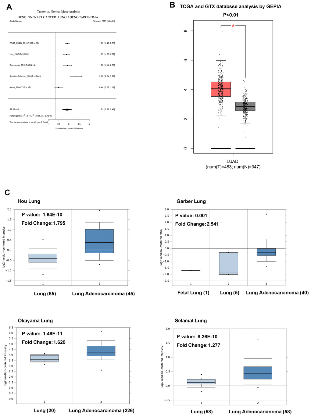 GNPNAT1 transcription level in LUAD. (A) The forest plot shows GNPNAT1 expression level meta-analysis of LUAD tumor tissues and normal tissues in five different LUAD cohorts (LCE). (B) The box plot shows GNPNAT1 mRNA expression levels of LUAD tumor tissues and normal tissues in the TCGA (GEPIA) datasets. (C) The box plot shows GNPNAT1 mRNA expression levels of LUAD tumor tissues and normal tissues in the Garber Lung, Okayama Lung, Selamat Lung, and Hou Lung datasets (Oncomine), respectively.