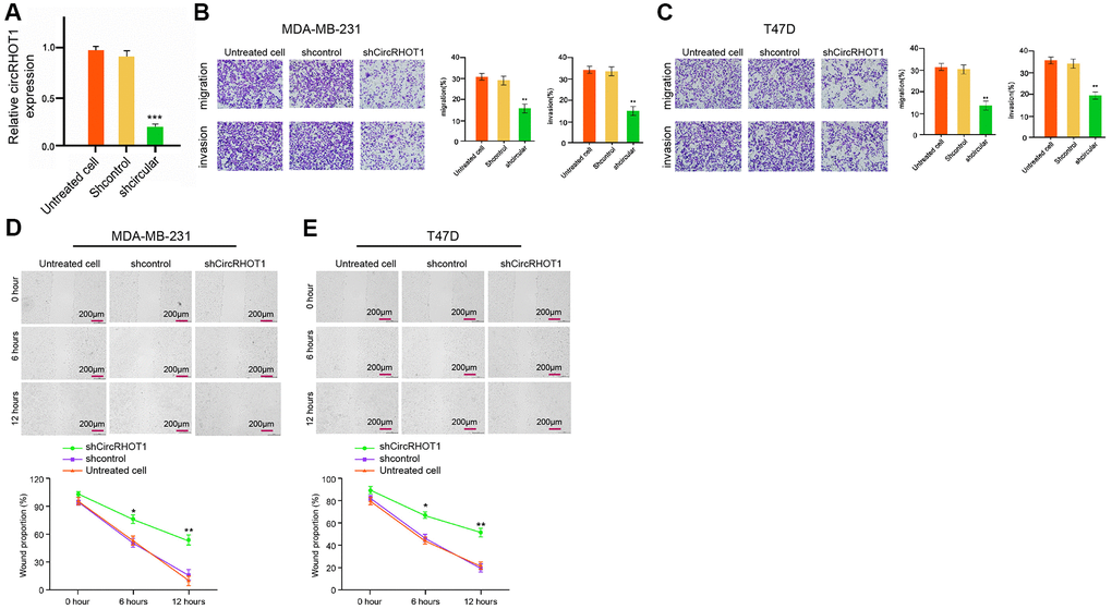 CircRHOT1 enhances invasion and migration of breast cancer cells. (A) The MDA-MB-231 cells were treated with control shRNA or circRHOT1 shRNA. The expression of circRHOT1 was measured by qPCR in the cells. (B–D) The MDA-MB-231 and T47D cells were treated with control shRNA or circRHOT1 shRNA. (B, C) The cell migration and invasion were analyzed by transwell assays in the cells. (D, E) The migration and invasion were examined by wound healing assays in the cells. The wound healing proportion was shown. Data are presented as mean ± SD. Statistic significant differences were indicated: ** P 