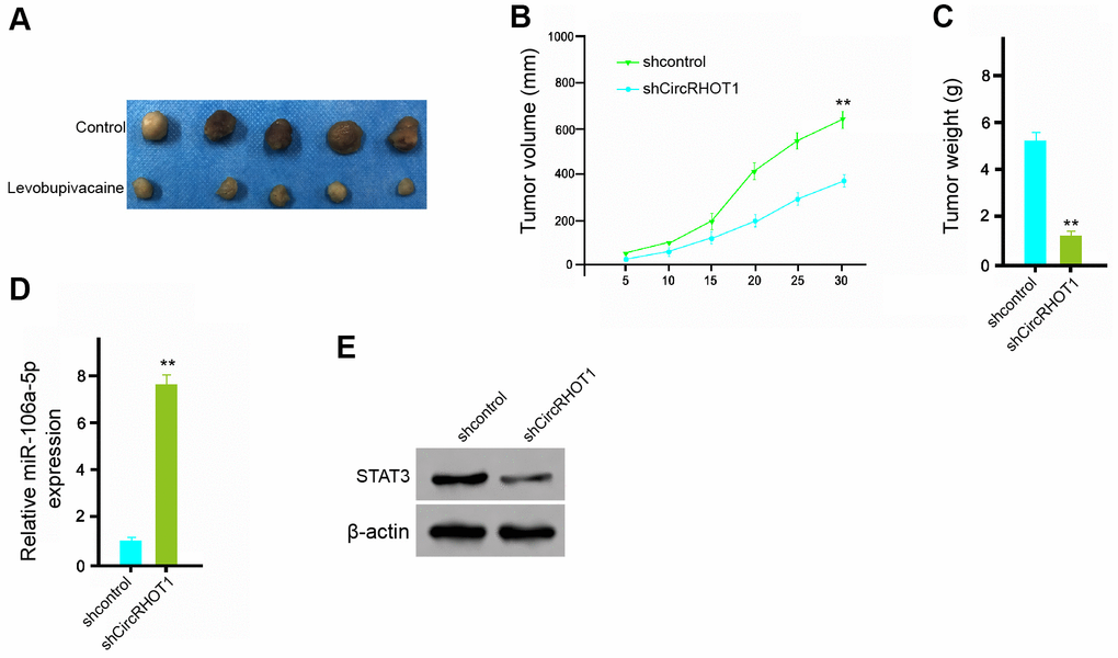 CircRHOT1 promotes the tumor growth of breast cancer in vivo. (A–E) The effect of circRHOT1 on tumor growth of breast cancer cells in vivo was analyzed by nude mice tumorigenicity assay by injected with the MDA-MB-231 cells treated with control shRNA or circRHOT1 shRNA. (A) Representative images of dissected tumors from nude mice were presented. (B) The average tumor volume was calculated and shown. (C) The average tumor weight was calculated and shown. (D) The expression levels of miR-106a-5p were measured by qPCR in the tumor tissues of the mice. (E) The protein expression of STAT3 and β-actin was assessed by Western blot analysis in the tumor tissues of the mice. N = 5. Data are presented as mean ± SD. Statistic significant differences were indicated: ** P 