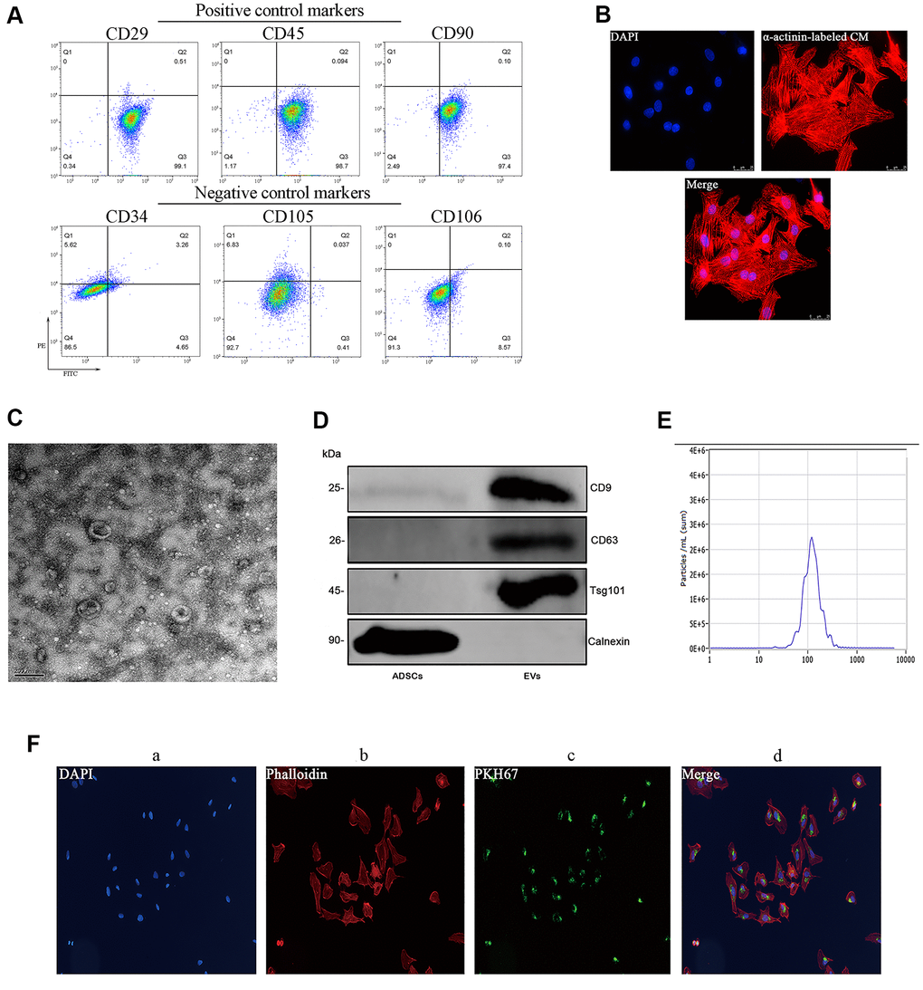 Characterization of mouse ADSCs and ADSC-derived EVs. (A) Analysis of cell surface markers (CD29, CD45, and CD90) in isolated mouse ADSCs; CD34, CD105, and CD106 were used as negative controls. (B) The purity of neonatal mouse cardiomyocytes was estimated to be higher than 95% based on α-actinin staining results. (C) TEM characterization of EVs. (D) Western blot examination of EV markers. Calnexin was used as negative control. (E) NanoSight’s light scattering intensity-based size distribution of isolated EVs. (F) EV tracer (PKH67) assay demonstrating successful EV internalization by cardiomyocytes.