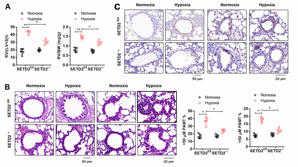 SMCs specific SETD2 deficient attenuates pathological remodeling of pulmonary artery and right ventricular hypertrophy. (A) The right ventricular hypertrophy was evaluated by the RV/BW ratio (the ratio of the right ventricular mass to the sum of body masses) and RV/(L+S) ratio (the ratio of the right ventricular mass to the sum of the left ventricular and septal masses). (B) Haematoxylin and eosin (HE) staining and the analyzed PAMT ration of both small and medium pulmonary arteries were used to evaluate the pulmonary blood vessel remodeling during the course of PAH development. (C) Histochemical staining of SETD2 immunostaining was used to detect the SETD2 expression in lung blood vessels. All data were presented as Mean±SD (n=5). *PP