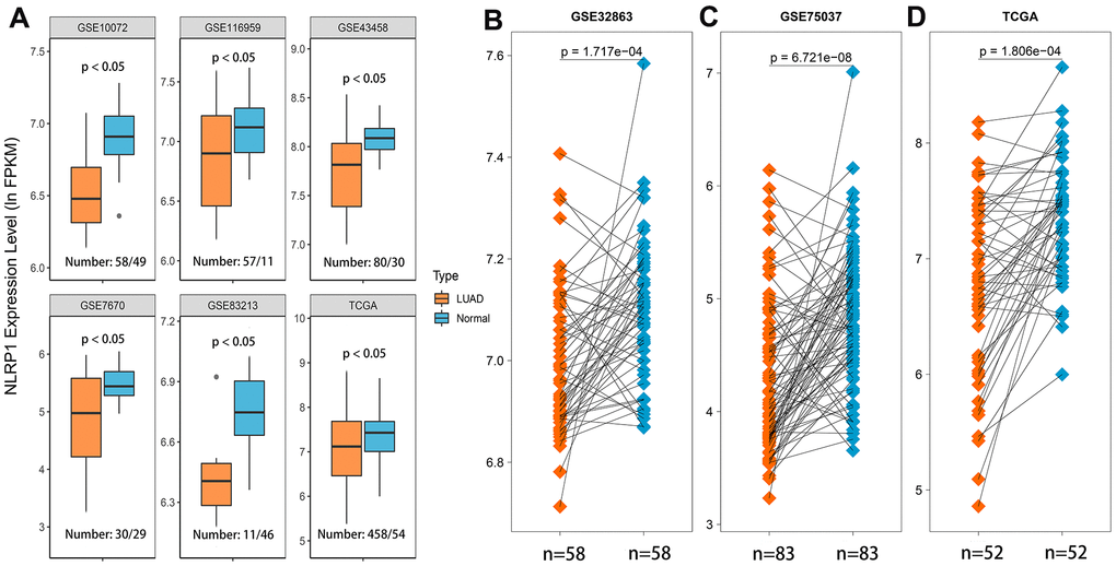 NLRP1 expression was significantly lower in LUAD tissues than in normal or adjacent normal tissues. (A) NLRP1 expression was significantly down-regulated in cancer tissues compared to normal tissues (p ). (B–D) NLRP1 was expressed at a lower level in LUAD tissues than noncancerous adjacent tissues (p ) with the comparison of 192 paired samples from three different LUAD datasets.