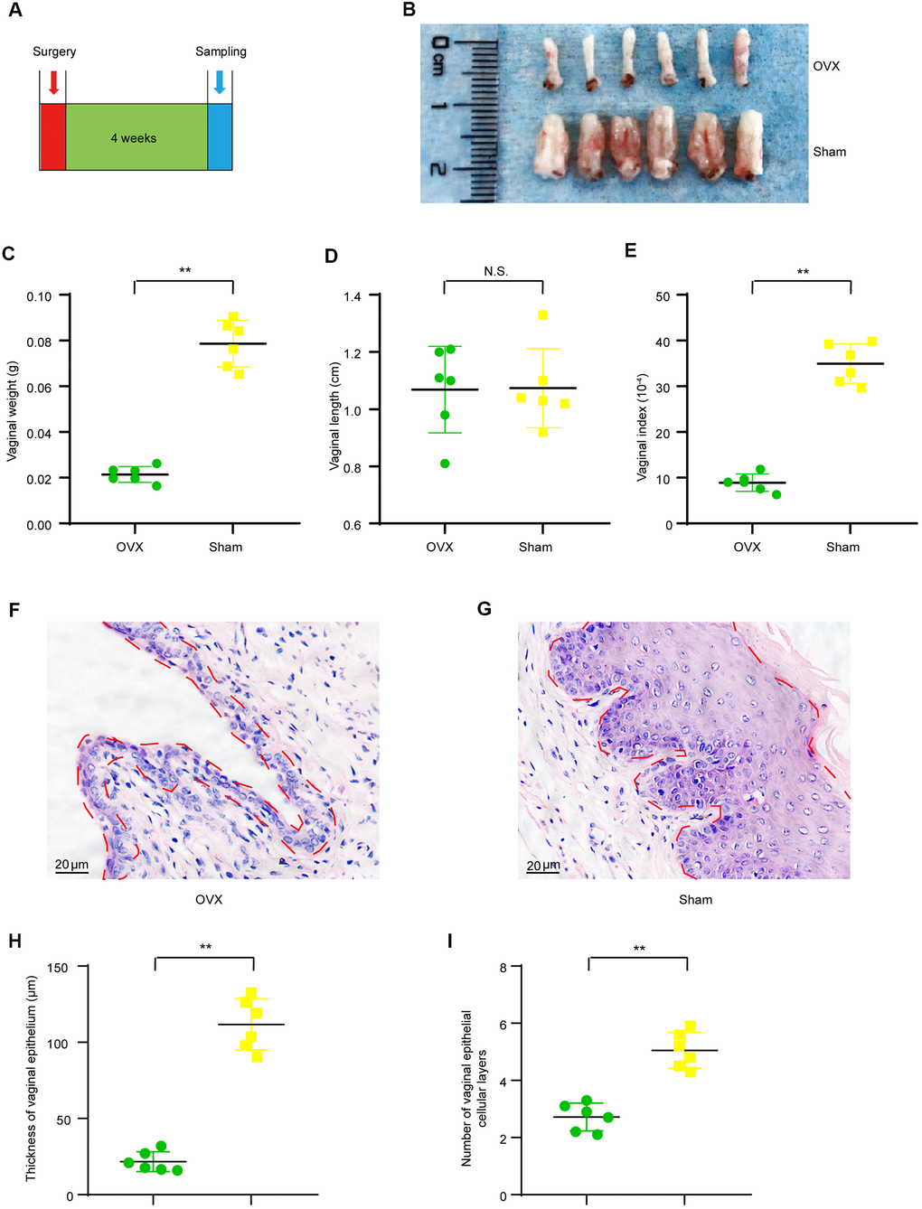 Vaginal morphologic changes in OVX group and Sham group mice. (A) The timeline for ovariectomy and sham surgery, fecal and vaginal tissue samples collection. (B) Representative images for isolated vagina of OVX group and Sham group. (C) Vaginal weight (t-test, PD) Vaginal length (t-test, P>0.05). (E) Vaginal index (vaginal weight/body weight*10-4) (t-test, PF, G) Representative image of Hematoxylin-Eosin staining for vaginas and the area delineated by the red dotted line indicating the epithelial layer of the vagina. (H) Average vaginal epithelial thickness (t-test, PI) Average number of vaginal epithelial cellular layers (t-test, PP P 