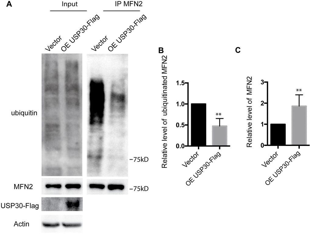 Effect of USP30 overexpression on the ubiquitination and protein expression of MFN2 in SK-N-BE(2) cells exposed to OGDR. SK-N-BE(2) cells were transfected with indicated plasmid. After transfection 36 h, SK-N-BE(2) cells were treated with 4 h OGD plus 4 h reperfusion. (A) After immunoprecipitation of MFN2, western blot was performed to examine the ubiquitination and protein level of MFN2 after 4 h reperfusion following 4 h OGD in SK-N-BE(2) cells. Transfection with USP30-Flag significantly attenuated OGDR induced ubiquitination of MFN2 and increased protein expression of MFN2. (B) Quantitation (Mean ± SEM) of ubiquitination of MFN2 from three independent experiments. (C) Quantitation (Mean ± SEM) of protein expression of MFN2 from three independent experiments. OE: over expression.