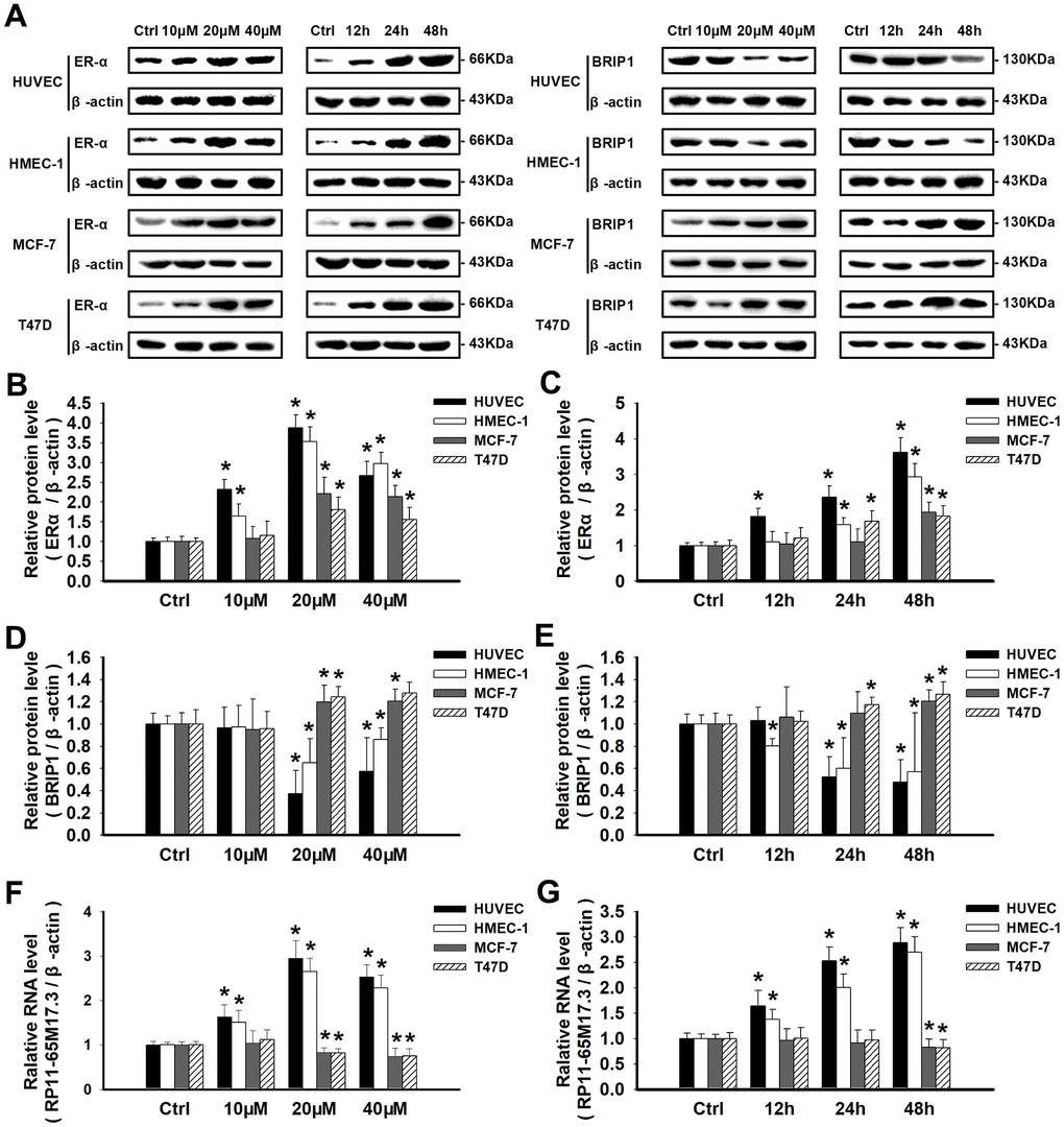 Calycosin regulated cell proliferation by activating or repressing the RP11-65M17.3-ERα loop. (A–E) HUVECs, HMEC-1 cells, MCF-7 cells and T47D cells were treated with calycosin (10, 20 and 40 μM) for 12, 24, or 48 h. Western blotting was used to determine the protein levels of ERα and BRIP1, and β-actin served as the internal control. (F, G) The levels of RP11-65M17.3 were determined by qRT-PCR and normalized to those of β-actin.