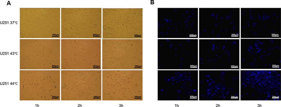 Heat shock was an efficient way to generate apoptotic U251 cells. (A) U251 cell morphology by heat induction 37° C, 43° C, 44° C for 1h, 2h, 3h respectively. With the prolongation of heat induction, the cells began to shrink, the cell density decreased, and the spacing between cells became significantly larger. (B) Apoptosis rate was calculated by Hoechst 33258 staining, which showed U251 cells had the highest apoptosis rate at 43° C 3h.