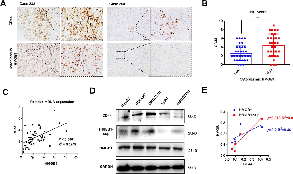 HMGB1 is positively associated with CD44 in HCC. (A) Representative images show different intensities of staining CD44 and cytoplasmic HMGB1 in HCC samples. Scale bars, 100um. (B) HCC Patients with high expression of cytoplasmic HMGB1 are characterized by high expression of CD44 through analyzing IHC score. n=68. (C) Positive correlation of CD44 and HMGB1 in HCC samples by analyzing the mRNA levels. n=50. (D, E) Different expression of CD44, HMGB1 and supernatant HMGB1 (HMGB1-sup) are measured in five HCC cell lines via immunoblot analysis and results are quantified. HMGB1-sup rather than HMGB1 is positively correlated with CD44. Data are means ± SEM, * means p