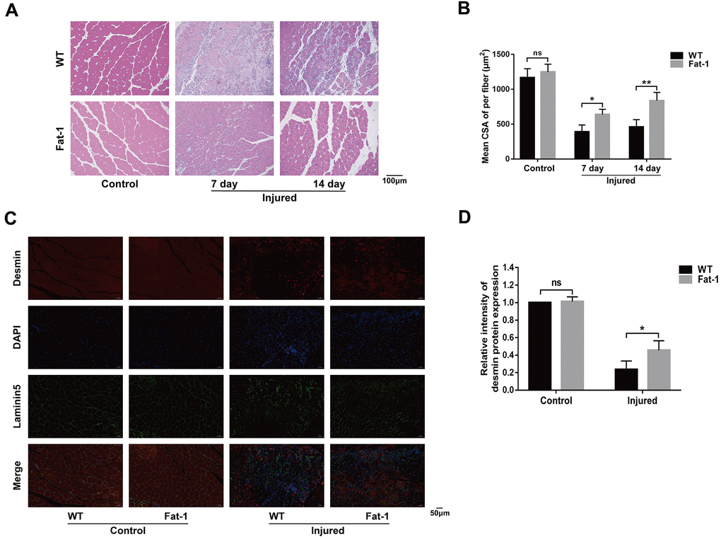 High endogenous n-3 PUFA levels attenuates cardiotoxin-induced skeletal muscle injury. (A) Representative images show H&E stained gastrocnemius muscle sections of fat-1 and wild-type mice on days 7 and 14 days after cardiotoxin-induced injury. Scale bar = 100 μm. (B) Quantitative data analysis shows the mean cross-sectional muscle fiber area. (C, D) Representative immunofluorescence images and quantitative data for the intensity of desmin protein expression at 7 days after injury. Scale bar = 50 μm. Data were expressed as the mean ± SD (n = 4-5). NS, non-significant; * P P 