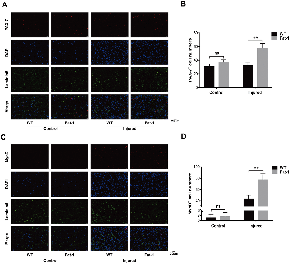 High endogenous n-3 PUFA levels increase muscle regenerative capacity in response to cardiotoxin-induced skeletal muscle injury in fat-1 mice. Representative immunofluorescence images and quantitative analysis shows the expression levels of (A, B) PAX-7 and (C, D) MyoD proteins in the gastrocnemius muscle tissues from Fat-1 and wild-type mice on day 3 after CTX-induced muscle injury. Scale bar = 20 μm. Data were expressed as the mean ± SD (n = 4-5). NS, non-significant; ** P 