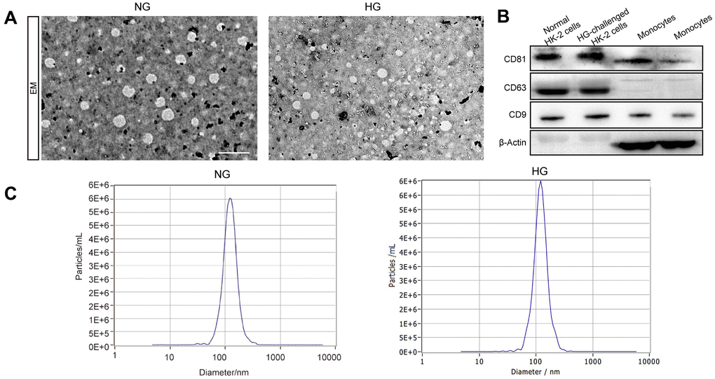 The identification of exosomes. Representative TEM image of exosomes derived from two groups (A). Western blot of the exosomal markers CD63, CD9, and CD81 and non-exosomal protein markers β-Actin in exosomes and monocytes (B). The size of the exosomes (nm) enriched from the culture supernatant of two groups was examined through NTA using a NanoSight NS300 instrument (NanoSight Ltd., Amesbury, UK) (C).