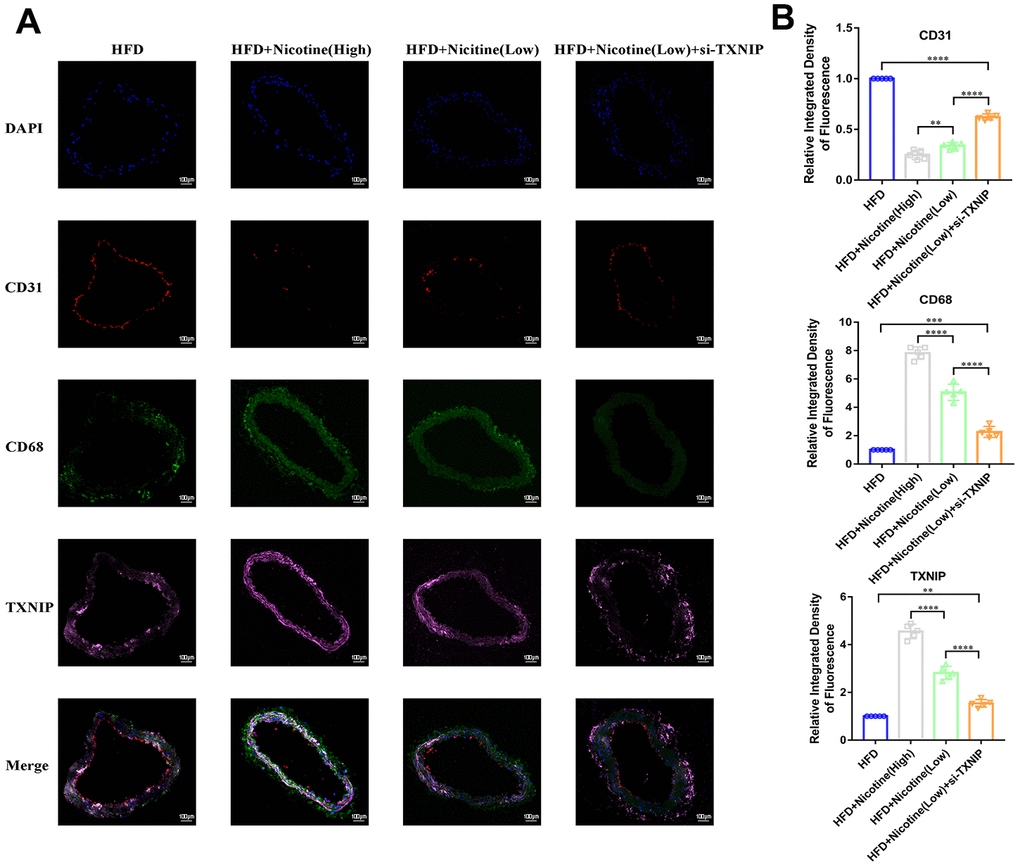 Nicotine enhances macrophage chemotaxis and TXNIP expression in plaque. (A, B) Triple immunofluorescence for CD68, TXNIP, and CD31 was used to analyze macrophage chemotaxis, TXNIP expression in vascular wall tissues, and vascular endothelium integrity, respectively, and their connection in the plaque of brachiocephalic trunk cross-sections (*P 