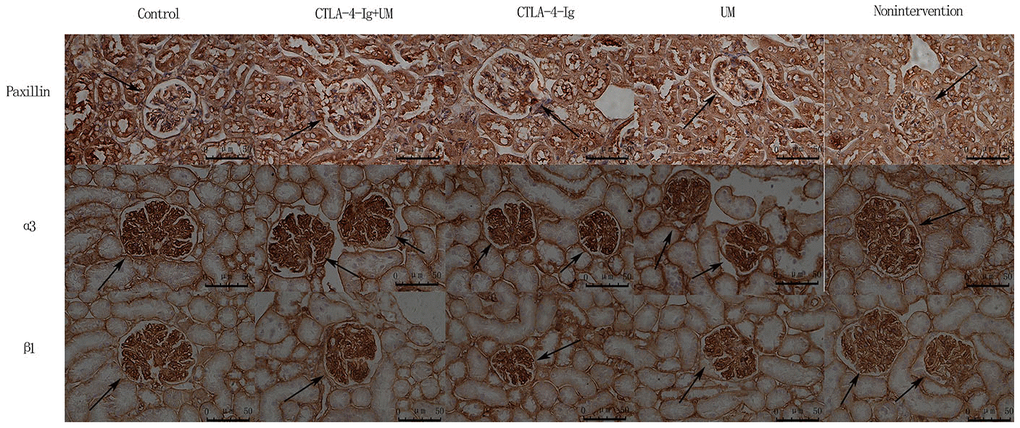 Analysis of renal Paxillin, α3, and β1 staining. Analysis of renal Paxillin staining. Control group: Strongly positive Paxillin expression in the glomerulus (black arrow); CTLA-4-Ig + UM group: Strongly positive Paxillin expression in the glomerulus (black arrow); CTLA-4-Ig group: Strongly positive Paxillin expression in the glomerulus (black arrow); UM group: Positive Paxillin expression in the glomerulus (black arrow); Non-intervention group: Positive Paxillin expression in the glomerulus (black arrow). Analysis of renal α3 staining. Control group: Strongly positive α3 expression in the glomerulus (black arrow); CTLA-4-Ig + UM group: Strongly positive α3 expression in the glomerulus (black arrow); CTLA-4-Ig group: Strongly positive α3 expression in the glomerulus (black arrow); UM group: Positive α3 expression in the glomerulus (black arrow); Non-intervention group: Positive α3 expression in the glomerulus (black arrow). Analysis of β1 staining. Control group: Strongly positive β1 expression in the glomerulus (black arrow); CTLA-4-Ig + UM group: Strongly positive β1 expression in the glomerulus (black arrow); CTLA-4-Ig group: Strongly positive β1 expression in the glomerulus (black arrow); UM group: Positive β1 expression in the glomerulus (black arrow); Non-intervention group: Positive β1 expression in the glomerulus (black arrow).