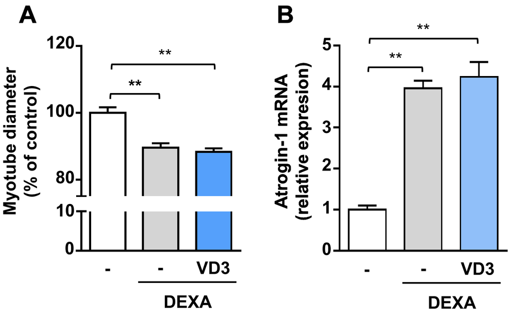 VD3 does not protect myotubes against atrophy induced by dexamethasone. (A) Myotube diameters were measured after 24 h treatment with 5 μM dexamethasone (DEXA) alone or in combination with 100 nM VD3. (B) Expression of Atrogin-1 (Fbxo32) was assessed by real-time RT-PCR. Data are presented as the mean ± SEM. ** P 