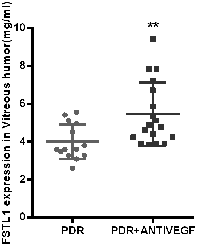 FSTL1 expressed higher in vitreous humor in the anti-VEGF-treated PDR patients. The level of FSTL1 expression in vitreous humor was significantly higher in the anti-VEGF-treated PDR patients than in the untreated PDR patients. Data are expressed as mean ± SEM. * means P 