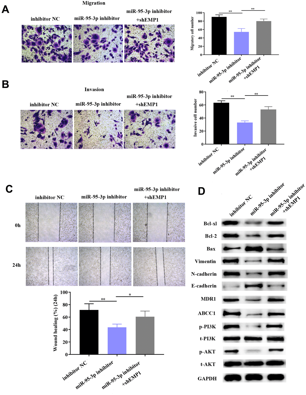 Down-regulation of EMP1 led to improved cell migration and invasion via activation of the EMT process and PI3K/AKT pathway. (A, B) Transwell chamber assay demonstrated that knockdown of EMP1 led to increased invasion and migration compared to the miR-95-3p inhibitor group. (C) Wound healing assay further verified that knockdown of EMP1 led to increased cell migration compared to the miR-95-3p inhibitor group. (D) Western blot assay indicated that knockdown of EMP1 induced up-regulation of neoplastic proteins (Bcl-xl and Bcl-2), activation of EMT and PI3K/AKT pathway compared to the miR-95-3p inhibitor group. ***p