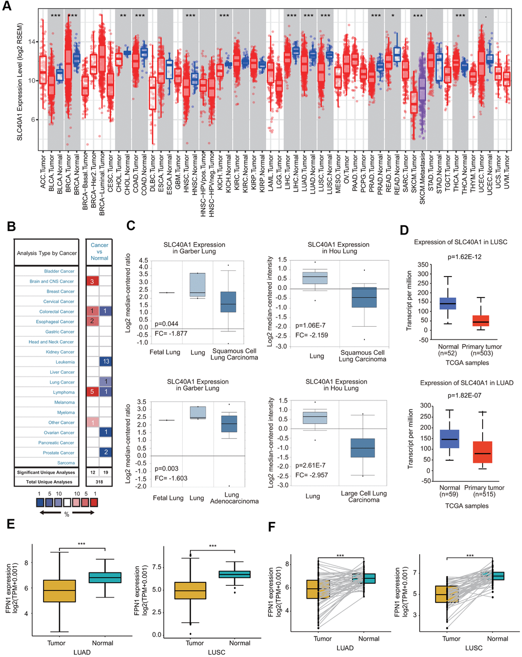 FPN1 mRNA expression in a variety of human cancers. (A) Human FPN1 expression in multiple types of cancer was determined using the TIMER database. (B) FPN1 expression was downregulated or upregulated in diverse cancers using the Oncomine database. (C) In the Garber Lung and Hou Lung datasets, the expression of FPN1 was decreased in LCLC, LUAD and LUSC tissues compared with normal tissues. (D) FPN1 was significantly downregulated in LUAD and LUSC in the UALCAN database. (E) FPN1 expression in lung cancer and adjacent normal tissues was statistically analyzed in the TCGA database. (F) TCGA database analysis and statistical analyses of the expression level of FPN1 were performed for 50 pairs of human lung cancer and adjacent paracancerous lung tissues. *p