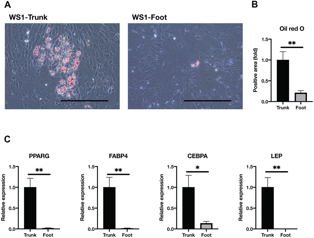 Adipogenesis was impaired in the foot fibroblasts. (A) Representative images of Oil red O staining after two weeks induction of adipogenesis in the trunk and foot fibroblasts of WS1. Bar = 300 μm. (B) Quantification of relative Oil red O staining area. Data are means ± SEM of two patients from four microscopic views. For statistical analysis, student t-test was performed (**pC) Relative gene expression analyzed by qRT-PCR. Data are means ± SEM of two patients with three technical replicates. For statistical analysis, student t-test was performed (*p