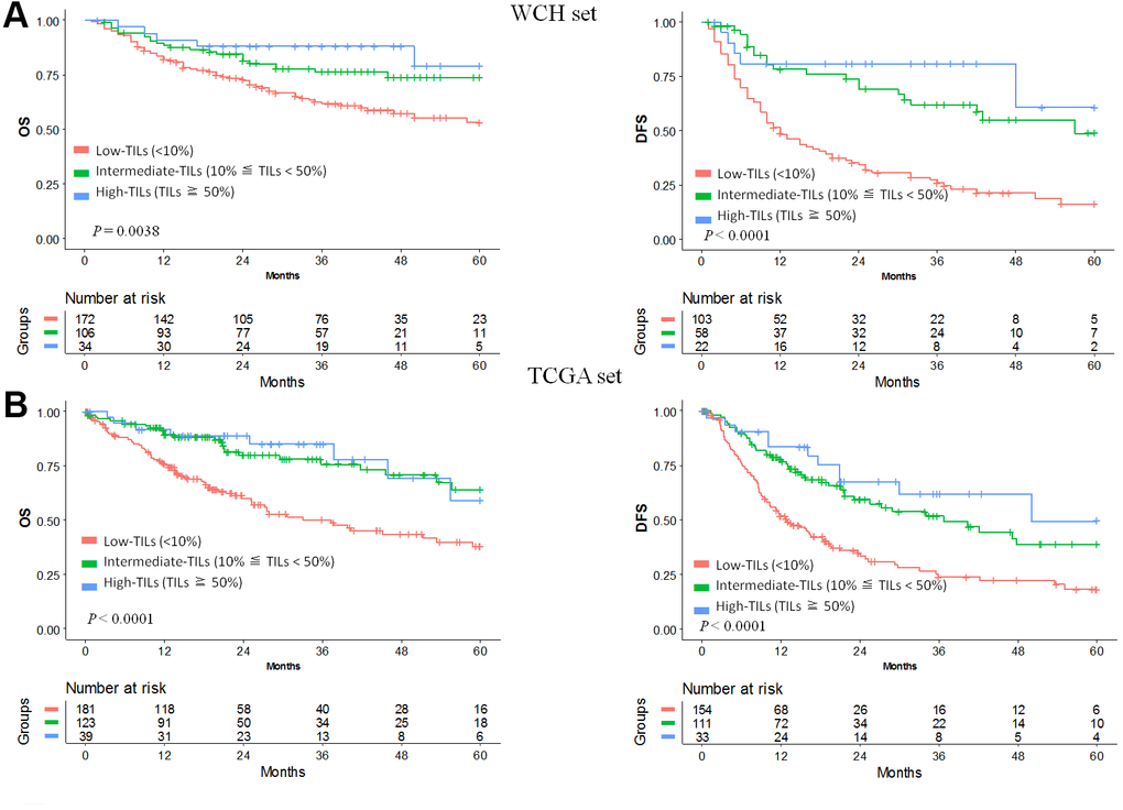 Prognostic value of TILs in hepatocellular carcinoma. Kaplan-Meier curves of estimated overall survival and disease-free survival in the WCH set (A) and the TCGA set (B). Patients without survival information were excluded from the analysis.