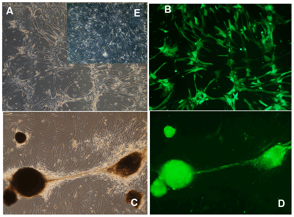 Morphological changes induced by long-term OSKM gene action in human umbilical cord perivascular cells (HUCPVC). (A) HUCPVC incubated for 7 days with an adenovector expressing a polyscistron harboring OSKM and GFP genes. Phase contrast microscopy; (B) The same field observed under fluorescence microscopy. (C) HUCPVC incubated for 85 days with the above OSKM-GFP adenovector. Phase contrast microscopy; (D) The same field as in C observed under fluorescence microscopy. Inset (E) Control intact HUCPVC on Experimental day 7. Obj X 4 in all panels. (Goya et al., unpublished results).