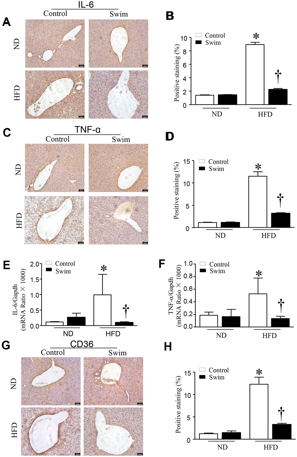 Exercise reduces inflammatory indices in HFD-fed mice. Representative and quantification with immunohistochemical staining of IL-6 (A, B), TNF-α (C, D) and CD36 (G, H) in the liver tissue. Quantification of mRNA for IL-6 (E), and TNF-α (F). Data are presented as mean ± SD, n = 6. * P 