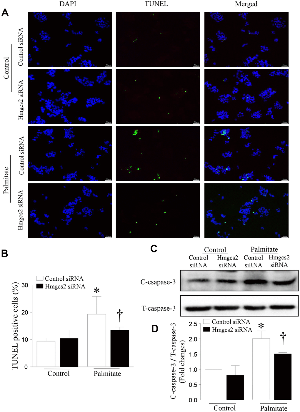 HMGCS2 regulated HepG2 apoptosis in lipotoxic conditions. Cell apoptosis was assessed by TUNEL staining (green), and the nucleus was stained using propidium iodide (PI) (blue). (A) Representative images of TUNEL staining. (B) Quantification of TUNEL-positive cells from three different independent cultures. (C) Representative western blot for cleaved caspase-3 and total caspase-3. (D) Quantification of cleaved caspase-3 protein levels relative to total caspase-3 from three different cultures. Data are presented as mean ± SD, n = 3. * P P 