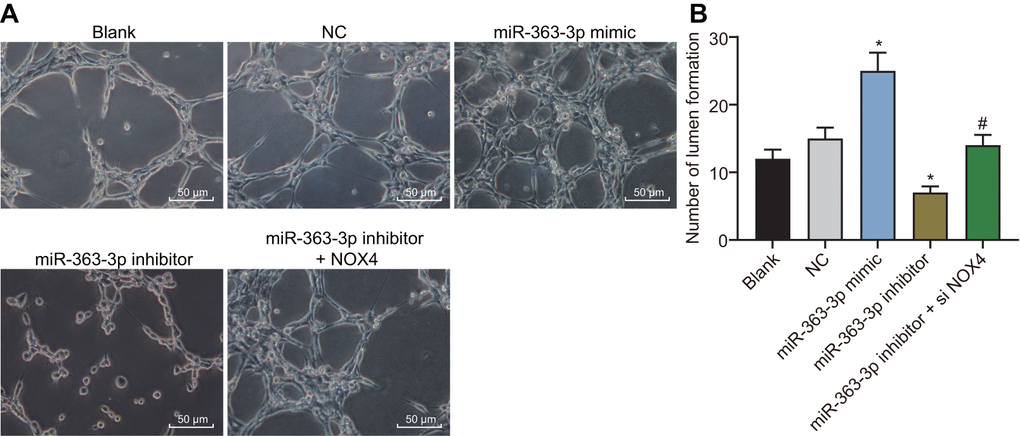 miR-363-3p enhances tube formation of CAECs by targeting NOX4. (A) representative images of the tubular structures in CAECs (scale bar = 100 μm); (B) quantification of tubular structures in CAECs; the data were analyzed by one-way ANOVA with Tukey's test; n = 3; * p NOX4, NADPH oxidase 4; NC, negative control.