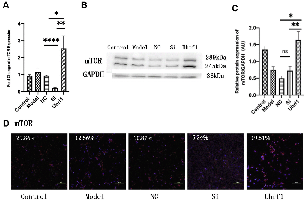 Uhrf1 promotes the expression of mTOR in MIRI. (A) The relative mRNA expressions of mTOR in Myocardial ischemia-reperfusion model in vitro were determined by qRT-PCR. (B) Western blot was used to detect the expression level of mTOR protein in each group. GAPDH serves as a loading control. (C) Expression of mTOR protein relative to GAPDH data from 3 biological repeats is shown. (D) Detection of mTOR protein expression and semi quantitative analysis by immunofluorescence microscopy (x200). Scale bar, 100μm. Data shown are mean ± SD. * P P P P in vitro oxidative stress model; NC, negative control of RNAi; si, RNAi knockdown of Uhrf1; Uhrf1, Uhrf1 overexpression.