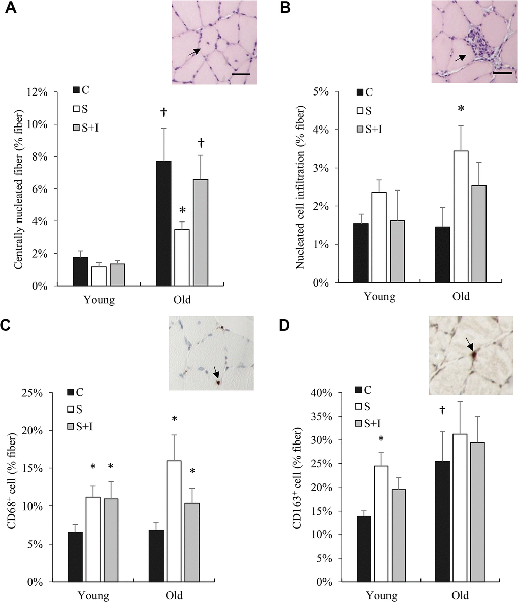 Bone marrow derived cell infiltration (CD68+ and CD163+ cells) in skeletal muscle of old rats altered by insulin. Centrally nucleated fibers (reflecting cell regeneration) (A), cell infiltration (B), CD68+ cells (C), and CD163+ cells (D) in soleus muscle from young and old rats were measured 5 days after streptozotocin injection (50 mg/kg/ml) and/or insulin injection (0.25 IU/kg twice a day). * Significant difference against C group, P 