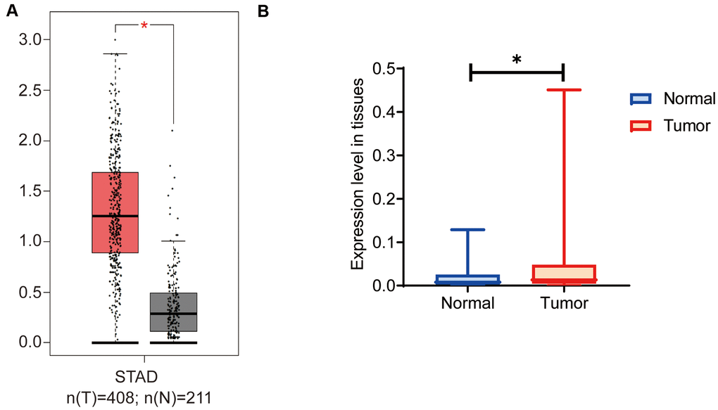 OGFRP1 expression increased in human gastric cancer tissues. (A) There are 408 cases of gastric cancer and 211 cases of normal gastric tissues included in the GEPIA dataset. The online analysis of OGFRP1 expression was performed, and the results showed that the expression of OGFRP1 was upregulated in gastric cancer (red box) compared with normal gastric cases (gray box). (B) The qPCR was performed to analyze OGFRP1 expression in tumor and normal tissues in 30 cases of gastric cancer. *P