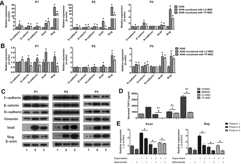 EMT-associated gene expression induced by LC-MSCs. (A) Equal number of A549.CopGFP and LC-MSCs were co-cultured directly for 48 hours and then sorted by cytometry flow to test the expression EMT-associated genes by realtime PCR. (B, C) Equal number of A549.CopGFP and LC-MSCs were co-incubated separately by transwell inserts for 48 hours. The EMT-associated gene expression in A549 cells was evaluated by realtime PCR (B) and western blot (C), individually. Representative results of three patients. TF-MSCs, comparison from normal lung tissues. (D), The level of TGF-β secreted by MSCs that derived from different tissues was tested by ELISA assay. (E), The induced snail and slug expression was blocked by TGF-β signaling inhibitor galunisertib. A549 cells were pre-incubated with galunisertib (5 μM) for 30 min, then treated by the supernatants of LC/NC-MSCs from 3 patients. *, P 