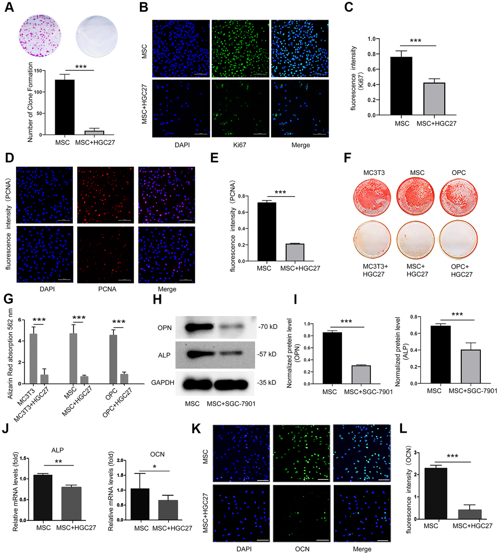 Co-culturing of osteoblasts with HGC27 or SGC-7901 cells in vitro confirms that gastric cancer cells inhibit the proliferation and differentiation of osteoblasts. (A) Colony formation assay showing that the proliferation ability of MSC cells was impaired upon co-culture with HGC27 cells. (B) Immunofluorescence staining of MSCs at day 3 of OS medium induction with or without co-cultured HGC27. Shown is Ki67 expression (green). Nuclei were stained with DAPI (blue). Scale bar, 100 μm. (C) Quantitative analysis of the fluorescence intensity in (B). (D) Immunofluorescence staining of PCNA (red) in MSCs at day 3 of OS induction with or without co-cultured HGC27 and Nuclei were stained with DAPI. (blue) states. Scale bar, 100 μm. (E) Quantitative analysis of the fluorescence intensity in (D). (F) Alizarin Red staining analysis of MC3T3, MSC, and OPC cells at days 16 of OS induction with or without HGC27 cells co-cultured. (G) Quantitative mineralization level based on (F). (H) Western blot analysis of OPN and ALP expression in MSCs with or without co-cultured SGC-7901. (I) Quantitative analysis of OPN and ALP protein levels from the immunoblots in (H). OPN and ALP protein levels were normalized to GAPDH (n=3). (J) qRT-PCR results showing ALP and OCN genes transcription levels in MSCs at day 3 of OS induction with or without co-culturing of HGC27. Expression levels of ALP and OCN were normalized to GAPDH expression. (K) Immunofluorescence staining of MSCs at day 3 of OS induction with or without co-cultured HGC27 to test OCN (green). Nuclei were stained with DAPI (blue) states. Scale bar, 100 μm. (L) Quantitative analysis of the fluorescence intensity in (K). Data are shown as mean±SEM. Statistical differences were obtained using Student's t-test, *, p