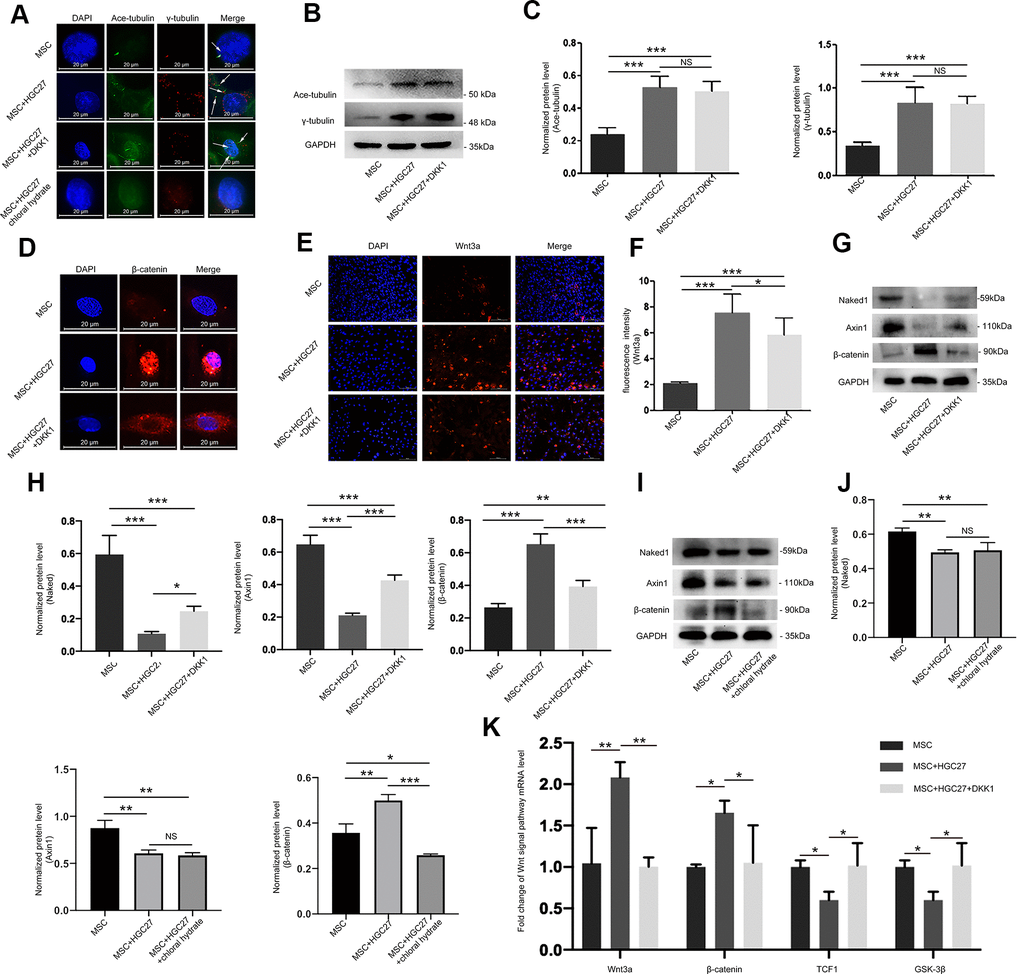 Abnormal overexpression of cilia caused by gastric cancer activates the Wnt/β-catenin signaling pathway in MSCs. (A) Analysis of primary cilia in MSC, MSC+HGC27, MSC+ HGC27+DKK1 and MSC+HGC27+chloral hydrate by immunofluorescence. Primary cilia were stained with anti-acetylated α-tubulin (axoneme, green) and anti-γ-tubulin (basal body, red) antibodies. Nuclei were stained with DAPI (blue). White arrows indicate cilia. Scale bars, 20 μm. (B) Western blot analysis of acetylated α-tubulin and γ-tubulin expression in MSC, MSC+HGC27 and MSC+HGC27+DKK1. (C) Quantitative analysis of protein levels in (B). Protein levels were normalized to GAPDH. (D) Analysis of β-catenin (red) expression by immunofluorescence in MSC, MSC+HGC27, and MSC+HGC27+DKK1 groups. Nuclei were stained with DAPI (blue). Scale bars, 20 μm. (E) MSC, or MSC co-cultured with HGC27 with or without DKK1 treatment were analyzed for Wnt3a (red) expression. Nuclei were stained with DAPI (blue). Scale bar, 100 μm. (F) Quantitative analysis of the fluorescence intensity in (E). (G) Western blot analysis comparing Naked1, Axin1, or β-catenin expression in the MSC, MSC+HGC27, and MSC+HGC27+DKK1 groups. (H) Quantitative analysis of protein levels in (G). The protein levels were normalized to GAPDH. (I) Western blot analysis comparing Naked1, Axin1, or β-catenin expression in the MSC, MSC+HGC27 and MSC+HGC27+chloral hydrate groups. (J) Quantitative analysis of protein levels in (I). The protein levels were normalized to GAPDH. (K) qRT-PCR results showing Wnt3a, β-catenin, TCF-1, and GSK-3β transcription levels in MSC, MSC+HGC27, MSC+HGC27+DKK1 on day 3 following OS induction. The gene expression levels were normalized to GAPDH expression. Data are shown as mean ± SEM. Statistical differences were obtained using One-way ANOVA with post-hoc testing, *, p