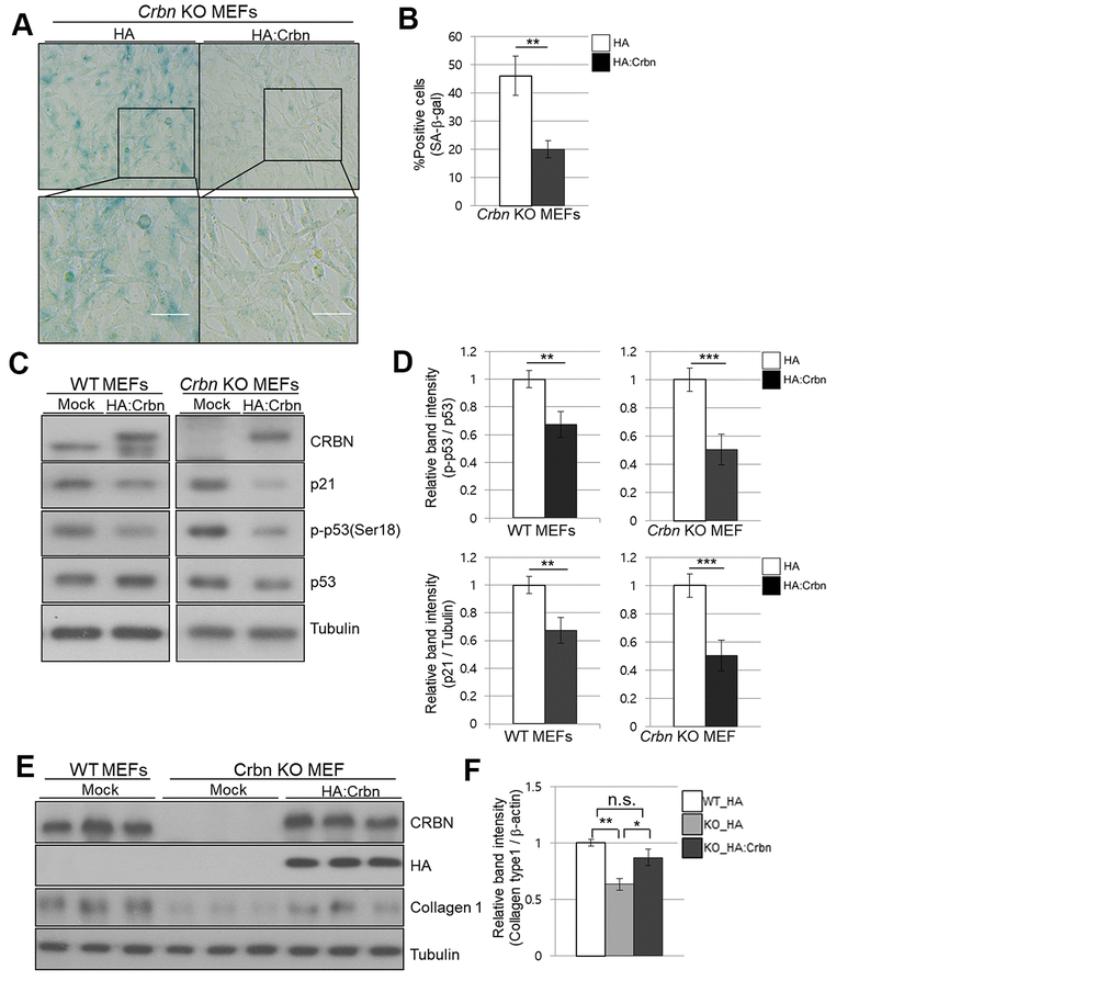 Ectopic overexpression of CRBN clears the SA-β-Gal signal and recovers the protein level of Collagen I in cultured fibroblast. (A) Representative staining images showing SA-β-Gal (blue-stained cells) along with the overexpression of CRBN in primary MEFs. Scale bar = 100μm. (B) Quantification of SA-β-Gal-positive cells shown in (A). Results are expressed as the percentage of stained cells (mean+SEM). The results shown are representative of four independent experiments. (C) The WT and CRBN KO primary MEFs were transiently transfected with HA: CRBN or empty vector. Cells were harvested after 24h and the protein lysates were subjected to immunoblotting with the anti-CRBN, anti-p53, anti-p-p53(Ser18), anti-p21, and anti–Tubulin antibodies. (D) The relative band ratio as determined by densitometric analysis of the blots in (C). (E) Cell lysates were prepared from WT and CRBN KO primary MEFs transfected with HA: CRBN or empty vector. Western blots of the protein lysate were probed with the anti-CRBN, anti-HA, anti-collagen I, and anti–Tubulin antibodies. Tubulin was used for equal protein loading. (F) The relative band intensity was measured by densitometric-analysis of the blots in (E). The results shown are representative of five independent experiments. *P P P 