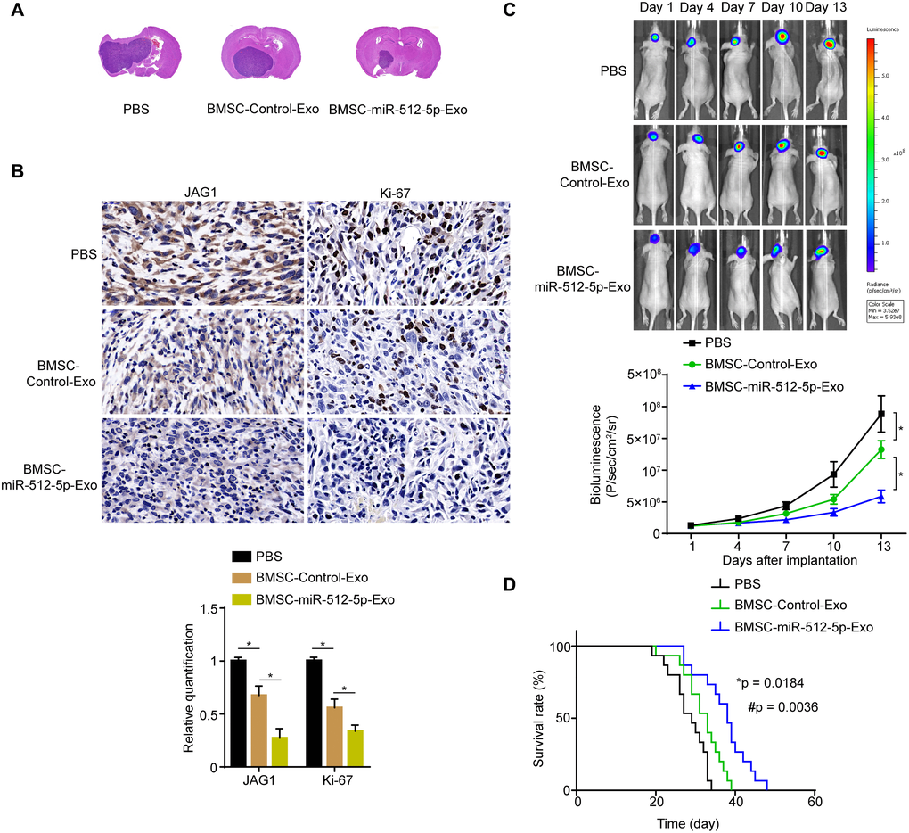 BMSC-exosomal miR-512-5p inhibits tumor growth in vivo. (A) Effect of BMSC-exosomal miR-512-5p as determined by HE in nude mice. (B) JAG1 and Ki-67 expression as determined by IHC. (scale bar = 50 μM) (C) Tumor growth as determined by bioluminescence imaging. after treatment with PBS or BMSC-derived exosomes. (D) Overall survival of nude mice receiving treatment was determined by Kaplan-Meier analysis. (n = 15, respectively). (*p = 0.0184, comparing the BMSC-Control-Exo group with the PBS group, #p = 0.0036, comparing the BMSC-miR-512-5p-Exo group with the PBS and BMSC-Control-Exo groups, Log-Rank test).