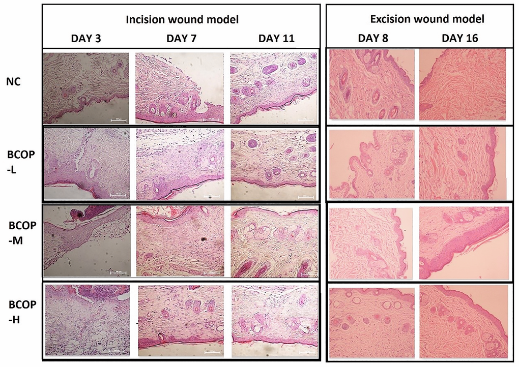 Effect of BCOP on wounds histology (HE staining) in mice. The incision site of NC showed irregular arrangement of collagen bundles, loose accumulation, and only moderate fibroblasts in the wound. BCOP-treated wound sites showed dense and compact collagen bundles with more fibroblasts, increased angiogenesis, and continuous epithelialization, reflecting faster wound healing compared to vehicle-treated groups. Magnification, × 200; NC, normal control group; BCOP-L, 0.75 g/kg bovine bone collagen oligopeptides group; BCOP-M, 1.50 g/kg bovine bone collagen oligopeptides group; BCOP-H, 3.00 g/kg bovine bone collagen oligopeptides group.