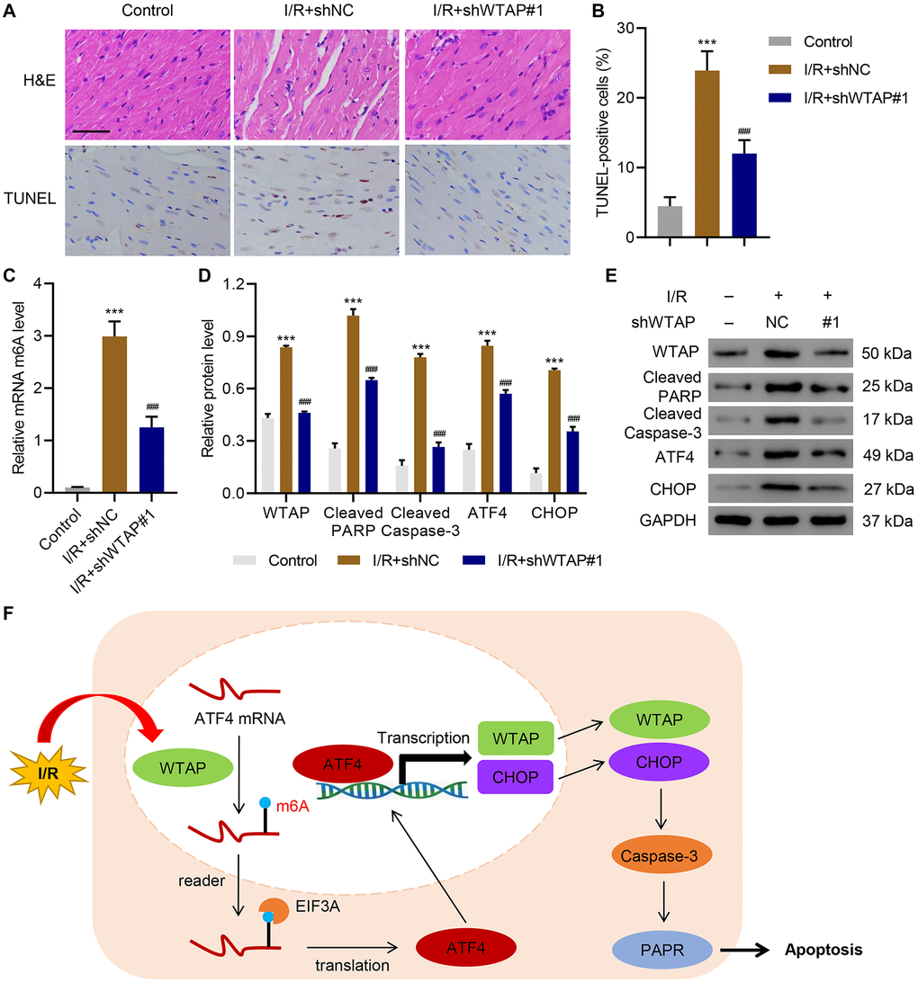 WTAP knockdown inhibits I/R injury in vivo. WTAP shRNA or negative control (shNC) was injected into rats. (A, B) H&E and TUNEL staining analysis of myocardium of rats. Scale bar: 50 μm. (C) The m6A levels in myocardium of rats were measured by ELISA. (D, E) Expression levels of WTAP, cleaved PARP, cleaved Caspase-3, ATF4 and CHOP in myocardial cells of rats. (F) Schematic diagram of the relationships among WTAP, m6A modification, and cell apoptosis under I/R condition. All experiments were repeated at least three times, and data are represented as mean ± SD. ***P ###P 