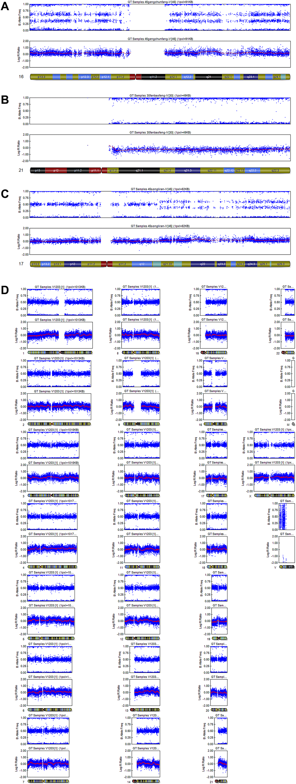 Representative examples of SNP results. (A) Single trisomy of chromosome 16. (B) Monosomy of chromosome 21. (C) Structural abnormality: duplication of chromosome 17. (D) Normal: arr (1–22) × 2, (X) × 2.