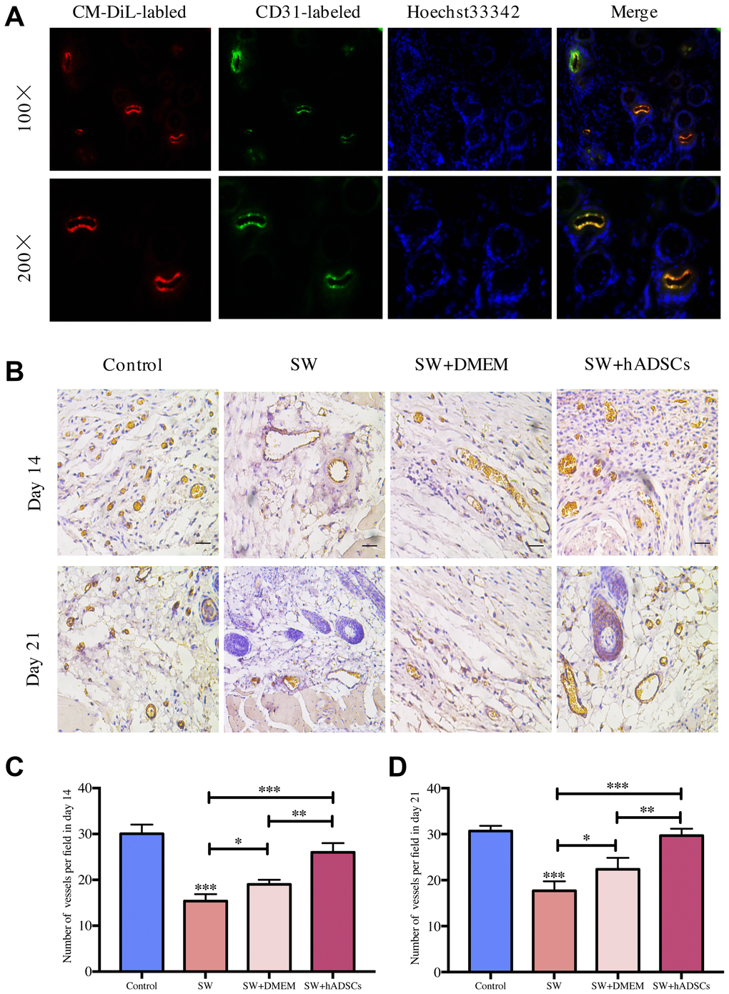 Microscopic evaluation of wound proangiogenic repair after SW and hADSC treatments. (A) the frozen section immunofluorescence showed that hADSCs (CM-DIL, red) differentiated into vascular endothelial cells (CD31, green) to promote wound healing. (B–D) the number of vessels per field in each group at day 14 and day 21. Scale bars indicate 100 μm. *P **P ***P 