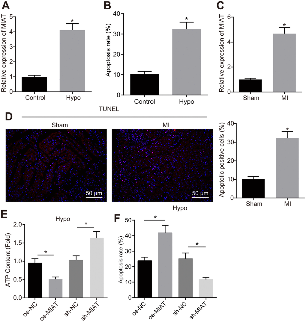 Upregulation of MIAT in hypoxic cardiomyocytes and myocardial tissues from the MI mice. (A) MIAT expression pattern in the cardiomyocytes determined by RT-qPCR normalized to GAPDH. (B) The cardiomyocyte apoptosis detected by flow cytometry. (C) RT-qPCR determination of MIAT expression pattern in the cardiomyocytes in mice 28 d after MI modeling (n = 10). (D) The apoptosis of cardiomyocytes in mice 28 d after MI modeling showed by TUNEL staining (scale bar = 50 μm). (E) The ATP content in hypoxic cardiomyocytes after alteration of MIAT. (F) The apoptosis of hypoxic cardiomyocytes after alteration of MIAT analyzed by flow cytometry. * p t test was used for comparison between two groups, and one-way ANOVA was applied for comparison between multiple groups followed by Tukey’s post hoc test. All the data was collected from 3 independent experiments respectively.