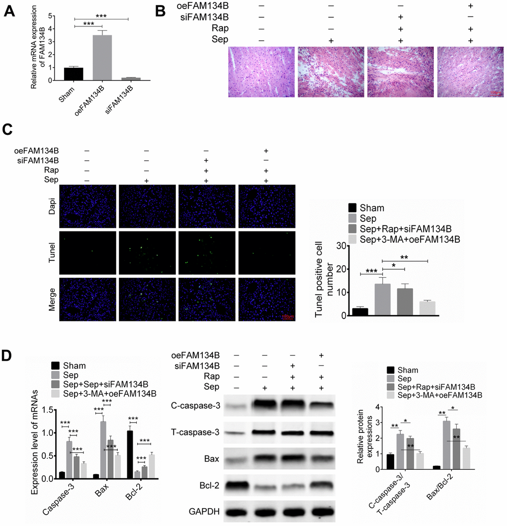 Effect of FAM134B on sepsis myocardial injury in mice. Mice were treated with FAM134B knockdown or overexpression and then with cecal ligation and puncture treatment. Mice were divided into four groups: Sham, Sep, Sep+Rap+siFAM134B, and Sep+3-MA+oeFAM134B. (A) The expression of FAM134B in myocardial tissue was detected by RT-PCR. (B–D) Myocardial tissue morphology and apoptosis were then identified by H&E staining and TUNEL analysis, respectively. Data are shown as mean ± SD. *P