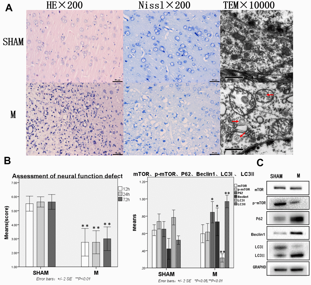 Compared with the sham group, brain tissue and brain function of rats with traumatic brain injury were significantly damaged and autophagy was enhanced. (A) HE staining, Nissl staining and transmission electron microscopy of brain tissue. (B) The neural function defect score at 12h, 24h and 72h. (C) mTOR, p-mTOR, P62, Beclin 1, LC3I and LC3II by Western-blotting. n=6.