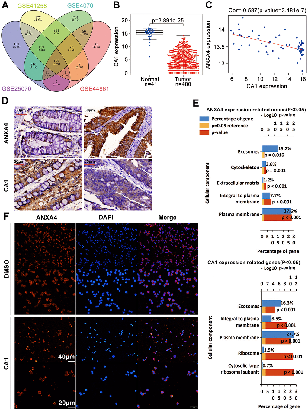 CA1 promoted ANXA4 aggregation in the cell membrane. (A) 187 commonly changed genes in CRC samples from the GSE 25070 (USA), GSE 41258 (Israel), GSE 44076 (Spain) and GSE 44861 (USA) datasets. (B) The CA1 mRNA expression level was significantly lower in colorectal cancer tissues than in normal tissues in the TCGA database. (C) Negative correlation analysis between ANXA4 and CA1 in the GSE 20916 and GSE 8671 datasets. (D) Decreased expression of CA1 and increased expression of ANXA4 in Chinese CRC samples, as determined by IHC (n=103). (E) Common cellular component enrichment results for CA1 and ANXA4 determined by GO analysis. (F) CA1 promoted ANXA4 aggregation in the cell membrane, as demonstrated by immunofluorescence imaging.