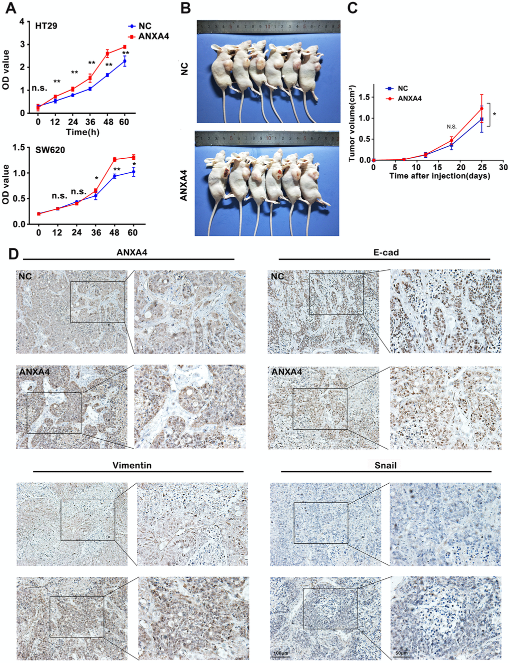 PDF) Abstract A74: Microparticles mediate cross-talk between tumoral and  endothelial cells and promote the constitution of an angiocrine  pro-metastatic niche through Arf6 up regulation