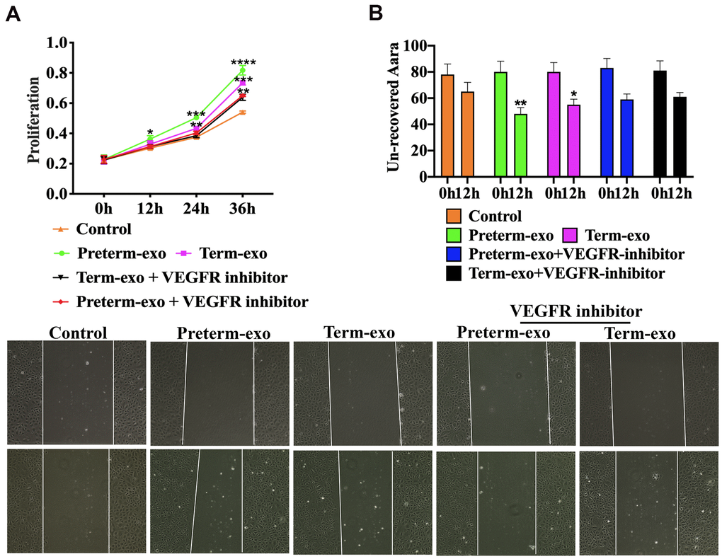 VEGFR inhibition blocks PC and TC exosome-induced FHC proliferation and migration. (A) TM and PM exosomes-induced proliferation, and (B) migration of FHC cells after VEGFR inhibitor intervention.