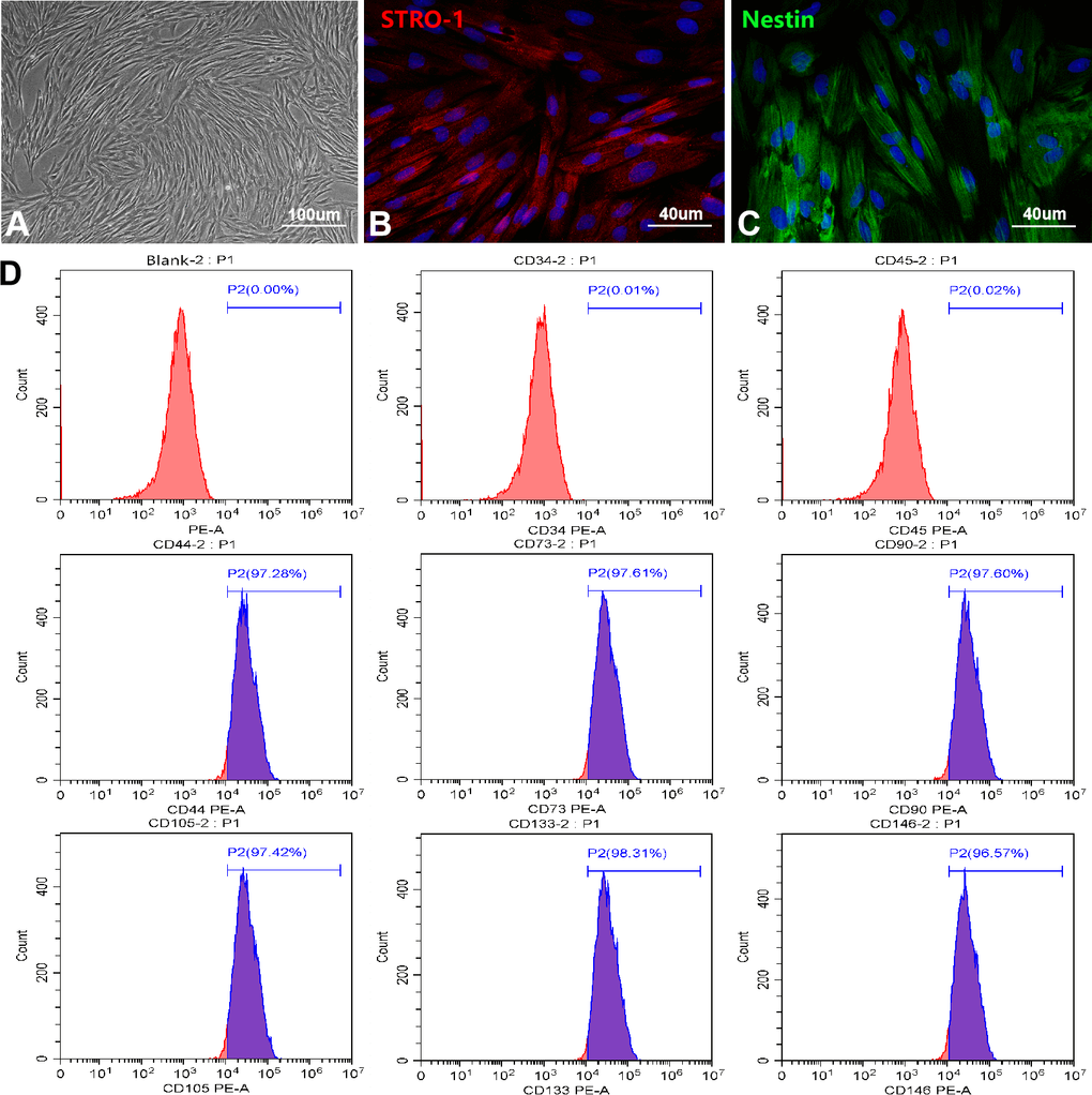 Culture and identification of OM-MSCs. (A) OM-MSCs were mainly exhibited spindle-shaped and a radial arrangement under light microscope. (B, C) The specific markers STRO-1 and Nestin of OM-MSCs were identified by immunofluorescence. (D) The surface markers and purity of OM-MSCs were detected by flow cytometry assay.