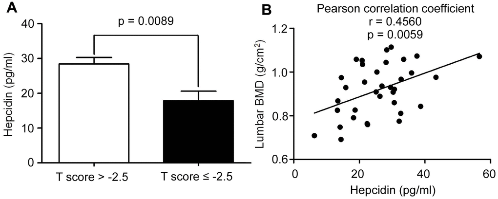 The hepcidin content is decreased in the postmenopausal women with osteoporosis. (A) Hepcidin concentration in the serum of peripheral blood in the postmenopausal women with osteoporosis (T score ≤ 2.5); (B) Lumbar BMD and serum hepcidin concentration showed a positive linear correlationship in the postmenopausal women with osteoporosis; r = 0.4560; statistical significance was considered at P = 0.0059, (n = 35; age = 62.11 ± 5.9).