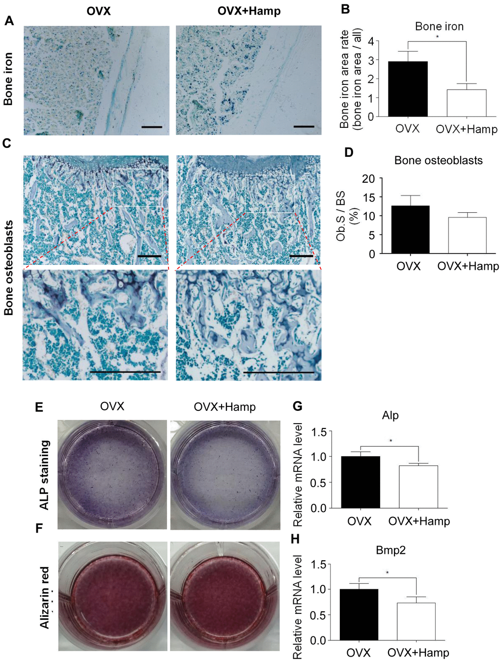 Hepcidin overexpression has little effect on osteoblasts in the OVX mouse. (A, B) Hepcidin overexpression decrease the irons contents in the mouse bone. (C, D) ALP stain shows that overexpression Hepcidin does not significantly inhibit the number of osteoblasts in femoral bone in the OVX mouse; (E, F) Osteoblasts, which cultured by mouse serum for 14 or 21 days, stained with ALP or alizarin red to assess its differentiation and mineralization; (G, H) Quantitative polymerase chain reaction (q-PCR) analysis of the expression of bone formation markers including Alp and Bmp2. Scale bar, 200 μm. The asterisks (*) indicate significant differences at P 