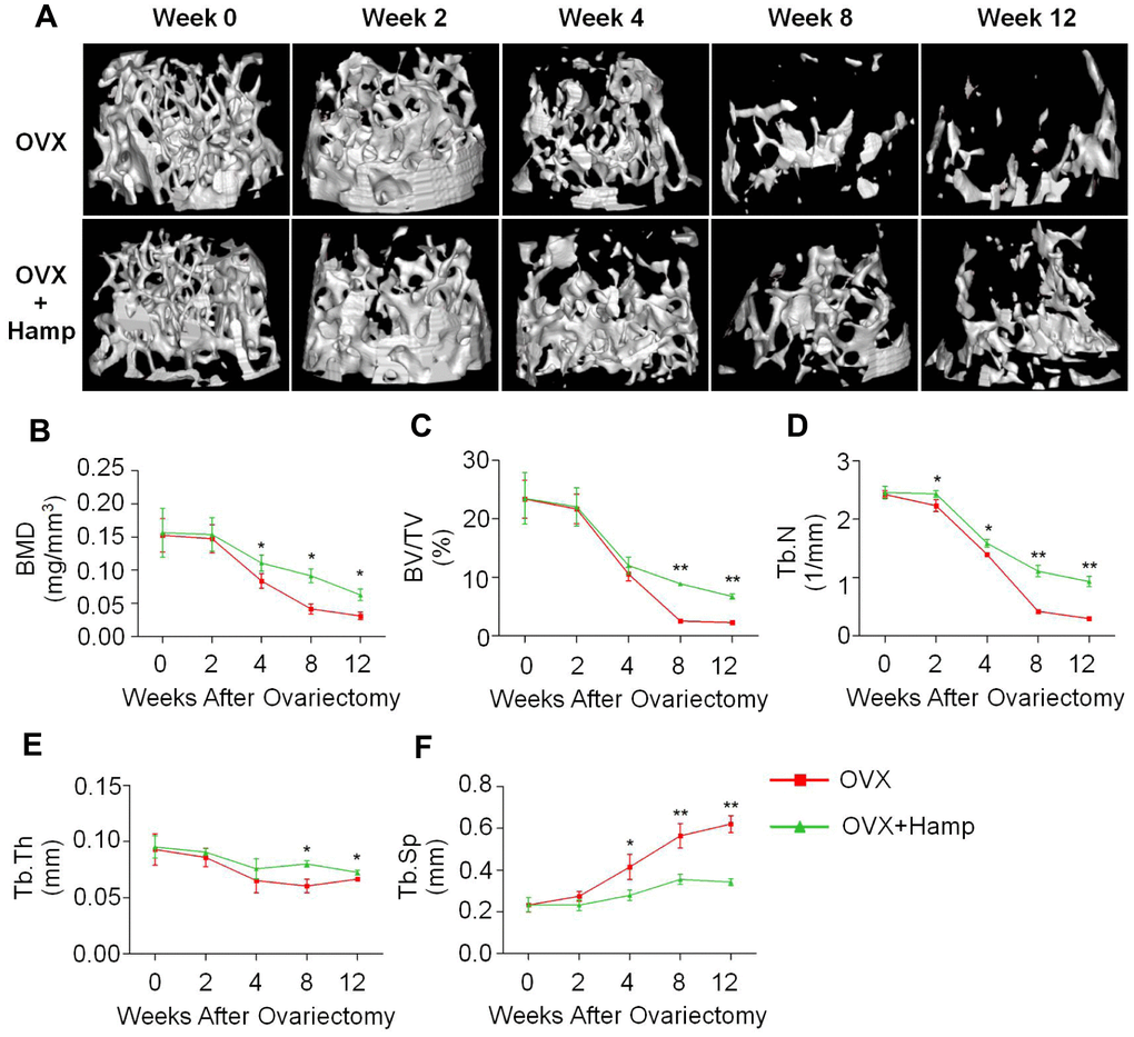 Hepcidin overexpression (HAMP) of hepcidin rescues bone loss induced by ovariectomy in mice. (A) The micro-CT showed that the loss of bone was rescued by overexpression of hepcidin in the OVX mouse. Micro-CT showed that (B) the distal femur bone mineral density and (C) the relevant parameters percent bone volume (BV/TV), (D) trabecular number (Tb.N), (E) trabecular thickness (Tb.Th) and (F) trabecular separation (Tb.Sp) were rescued by overexpression of hepcidin in the OVX mouse. Student's t-test was performed to determine statistic difference. The asterisks (*, **) indicate significant differences at P 