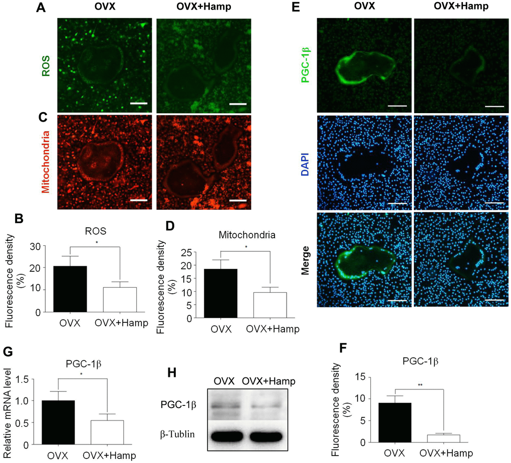 Hepcidin overexpression inhibits ROS production, mitochondrial biogenesis, and PGC-1β expression in osteoclasts. Bone marrow macrophages were extracted from femur and cultured with M-CSF and RANKL for 8 days. (A, C) The smaller cells are undifferentiated bone marrow macrophages and the larger cells in the middle are completely differentiated mature osteoclasts; (A) DCFH-DA and (C) mitochondrion-selective probes were used for assessing ROS and mitochondrial number in un-or-differentiated osteoclasts; (B, D) Mean fluorescence density of intermediate mature osteoclasts was measured to represent ROS and mitochondrial number respectively; (E) The smaller cells are undifferentiated bone marrow macrophages and the larger cells in the middle are completely differentiated mature osteoclasts; Immunocytofluorescence was used for assessing PGC-1β (E) in the osteoclasts, which were extracted from femur and cultured with M-CSF and RANKL for 8 days; (F) Mean fluorescence density of intermediate mature osteoclasts was measured to represent PGC-1β protein level; (G) the PGC-1β expression level was evaluated using qRT-PCR in osteoclasts; (H) PGC-1β protein levels were analyzed by western blotting in osteoclasts. Scale bar, 50 μm. The asterisks (*, **) indicate significant differences at P 